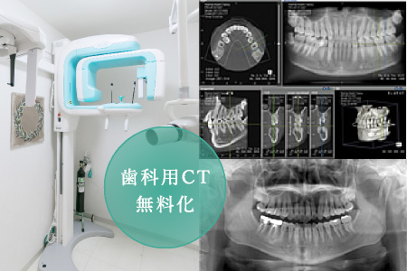 歯科用CT無料化