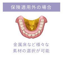 保険適用外の場合 クラスプがないもの
などの選択が可能